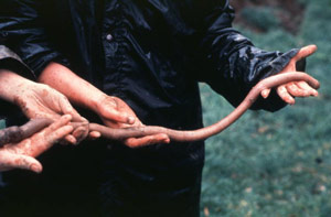 earthworm skin